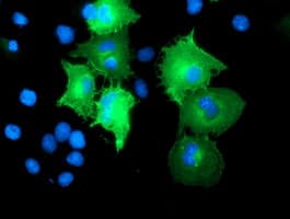 CCM2 / Malcavernin Antibody (clone OTI2E4, Carrier-free)