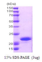 Human PPP1R14A / CPI-17 Protein (Recombinant His)