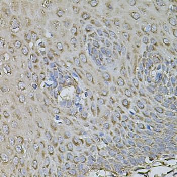 FDX1 / ADX Antibody