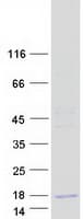 Human OTOR / Otoraplin Protein (Recombinant Myc-DDK (Flag))