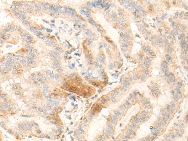Polyclonal Rabbit anti-Human BZW2 Antibody (IHC)