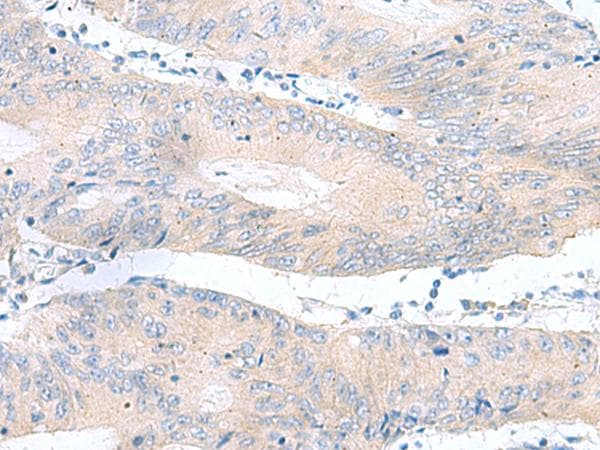 RPS16 / Ribosomal Protein S16 Antibody