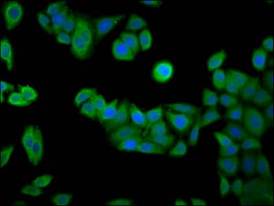 Polyclonal Rabbit anti-Human RAB24 Antibody (IF)