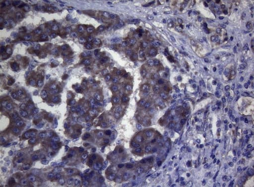 MAK Antibody (aa291-623, clone OTI5A7)