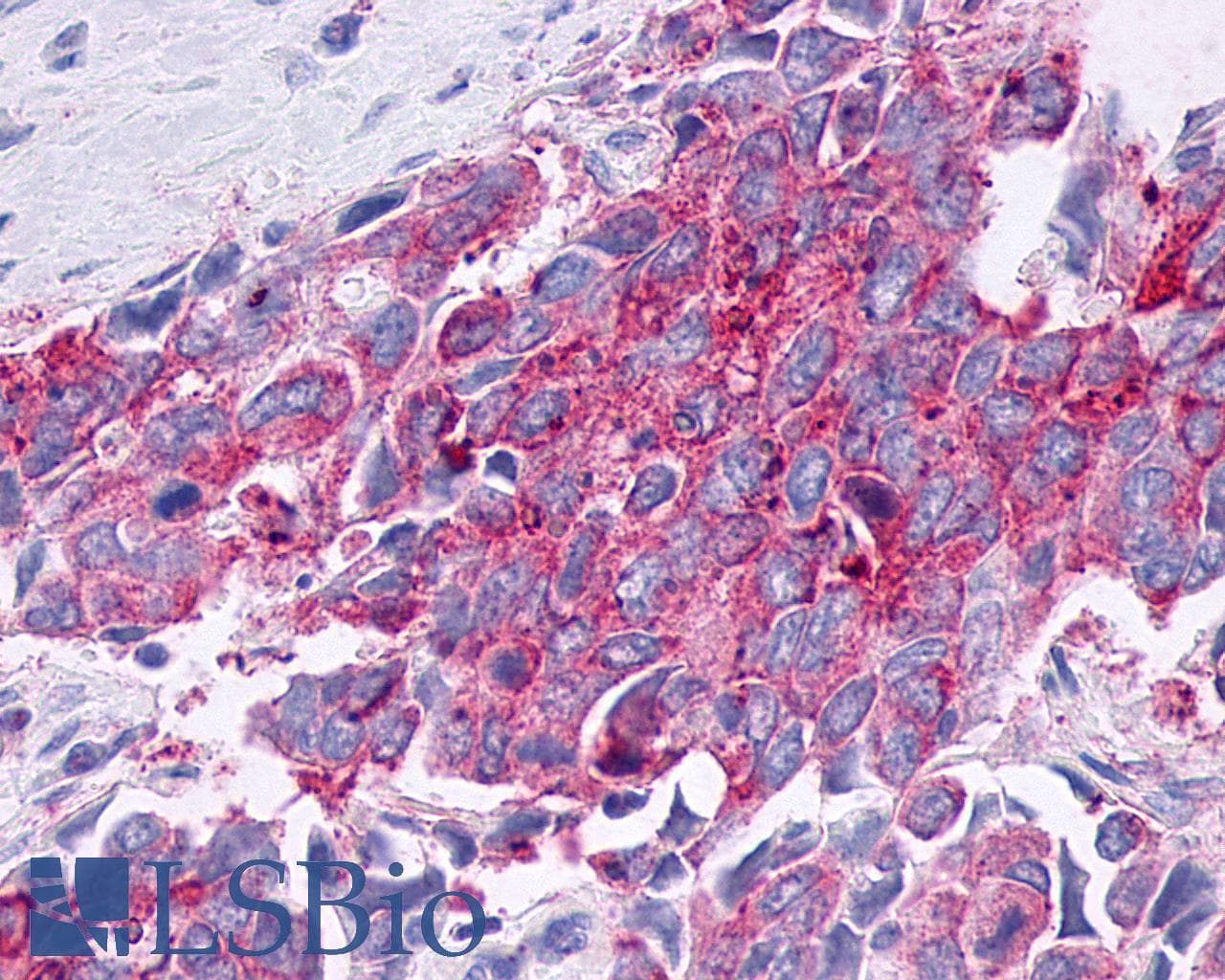 PathPlus™ Polyclonal Rabbit anti-Human F2RL3 / PAR4 Antibody (Extracellular Domain, IHC)