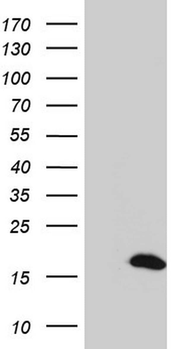 S100A9 / MRP14 Antibody (clone OTI2C5)