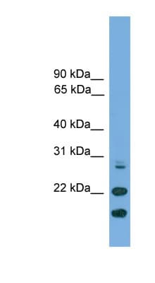 ASF1A Antibody (N-Terminus)