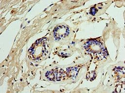 IMPDH2 Antibody (aa215-514)