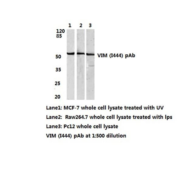 Polyclonal Rabbit anti-Human Vimentin Antibody (Ile444, IHC, IF, WB)