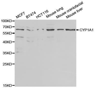 IHC-plus™ CYP1A1 Antibody