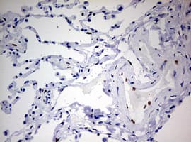 ZEB1 / AREB6 Antibody (aa1-350, clone OTI7E12)