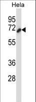CTTN / Cortactin Antibody (aa273-302)