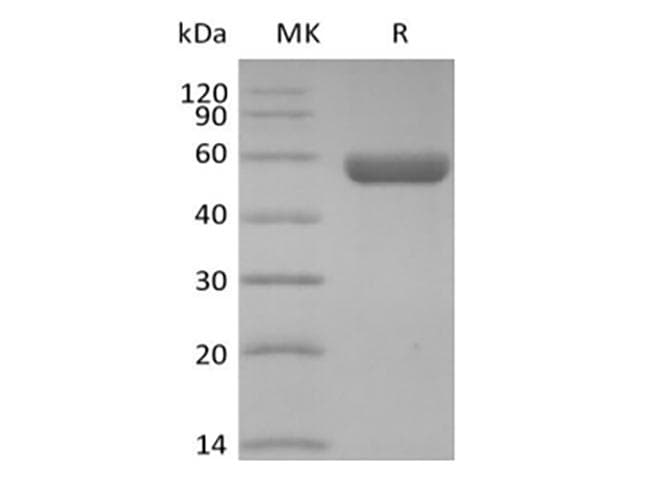 Human Hla-dqa1 gene (dqa1*0201, dqa1*03011 and dqa1*0303) Protein (Recombinant 10His, C-terminus)