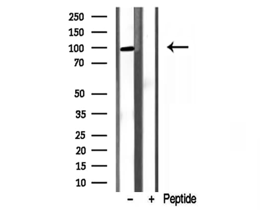 PYGL Antibody