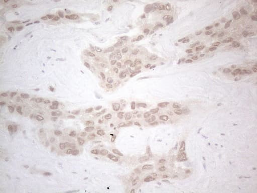 ZNF200 Antibody (clone OTI7C6)