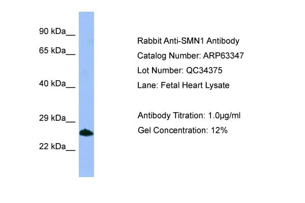 SMN1 Antibody (C-Terminus)