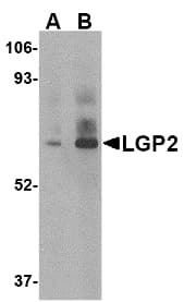 DHX58 / LGP2 Antibody