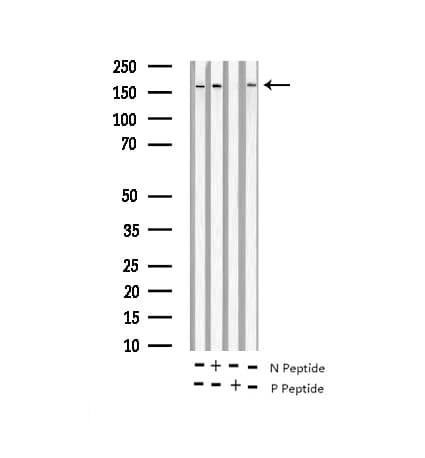 GRIN2B / NMDAR2B / NR2B Antibody (phospho-Tyr1474)