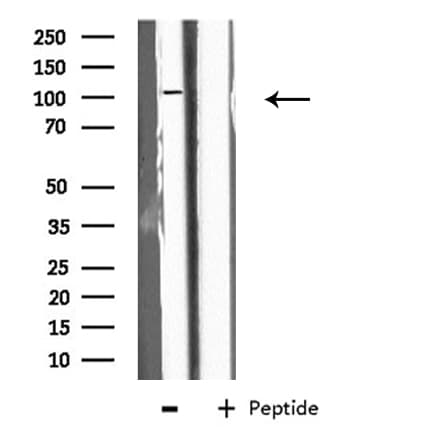 EPB41L2 Antibody
