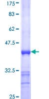 Human GOT2 Protein (Recombinant GST, N-terminus)
