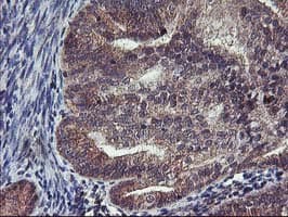 FGFR2 / FGF Receptor 2 Antibody (clone OTI5C5)