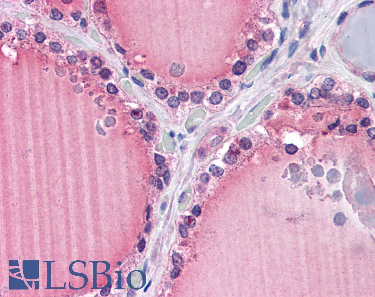 IHC-plus™ FZD9 / Frizzled 9 Antibody (aa579-590)