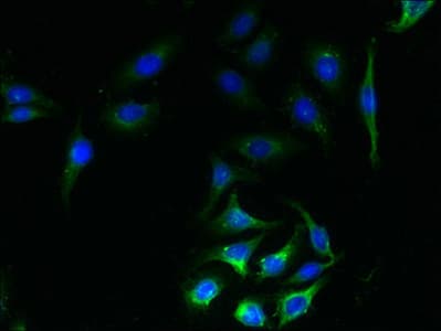 SLC23A1 / SVCT1 Antibody