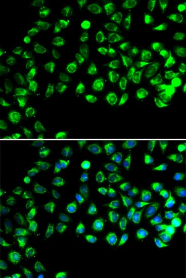 CFAP20 / GTL3 Antibody