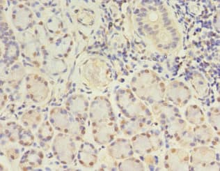 Polyclonal Rabbit anti-Human GJB5 / CX30.1 / Connexin 31.1 Antibody (aa211-273, IHC)