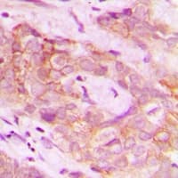 DUS2 / DUS2L Antibody