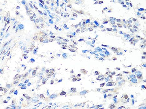 MTA2 Antibody