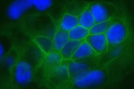 CLDN1 / Claudin 1 Antibody (C-Terminus, clone 2H10D10)