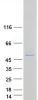 Human SLX4IP / C20orf94 Protein (Recombinant Myc-DDK (Flag))