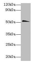 CHRNA1 Antibody