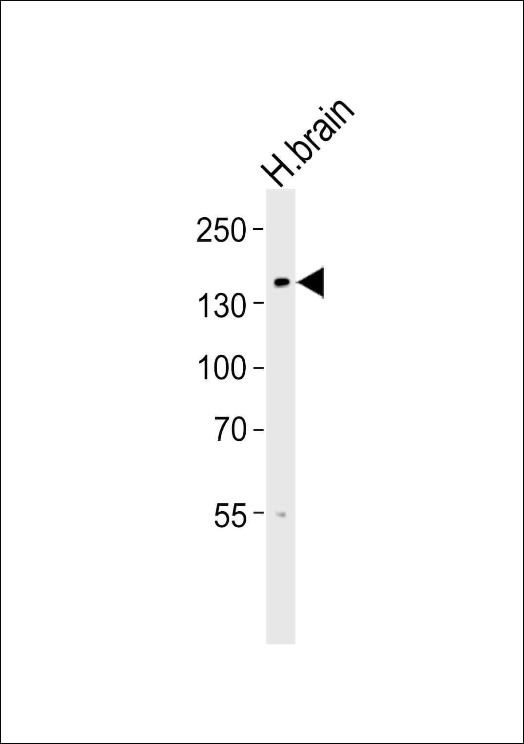 TRPM8 Antibody (aa521-552)