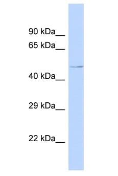 Polyclonal Rabbit anti-Human UBAC1 / KPC2 Antibody (aa22-71, WB)