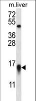 MYCBP Antibody (aa1-30)