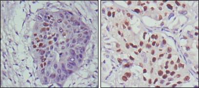 Monoclonal Mouse anti-Human TP53 / p53 Antibody (clone 4A8, IHC, WB)