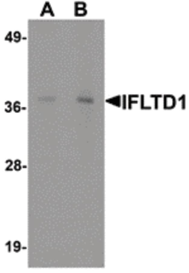 IHC-plus™ Polyclonal Rabbit anti-Human LMNTD1 / IFLTD1 Antibody (IHC, WB)