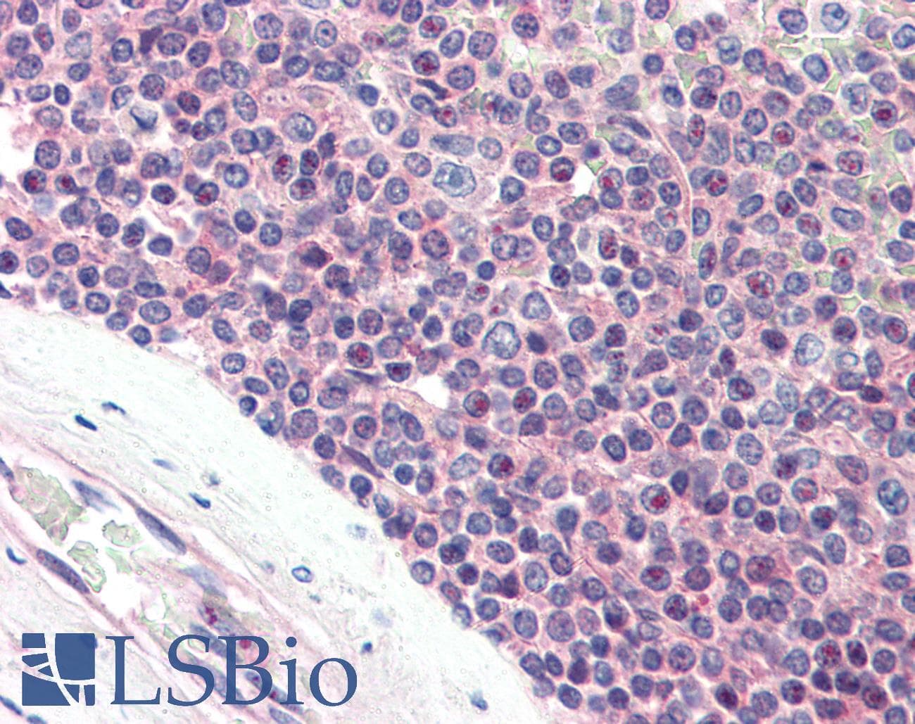 IHC-plus™ Polyclonal Rabbit anti-Human SYNGR2 / Synaptogyrin 2 Antibody (N-Terminus, IHC)