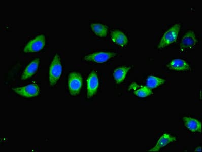 CARD10 / CARMA3 Antibody (aa863-1032)