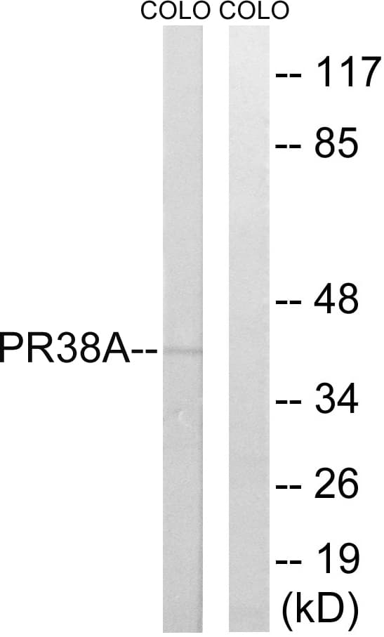 Polyclonal Rabbit anti-Human PRPF38A Antibody (aa104-153, WB)