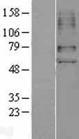 SLC22A6 / OAT1 Protein (Over-Expression Lysate Myc-DDK (Flag))