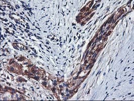 HARS2 Antibody (clone OTI2D6)