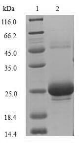 Rat USAG1 / SOSTDC1 Protein (Recombinant 10His, N-terminus + Myc, C-terminus)