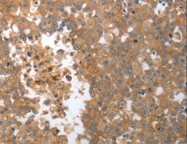 Polyclonal Rabbit anti-Human MMP27 Antibody (IHC)