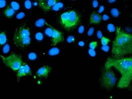 Monoclonal Mouse anti-Human SENP2 Antibody (clone OTI6F1, IHC, IF, WB)