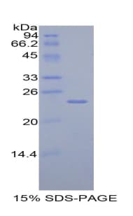 Rat TIMP4 Protein (Recombinant His)