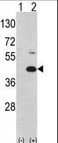 Polyclonal Rabbit anti-Human MOS Antibody (aa1-30, IHC, WB)
