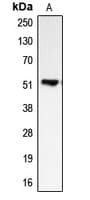 IHC-plus™ Polyclonal Rabbit anti-Human BMP5 Antibody (Internal, IHC, WB)